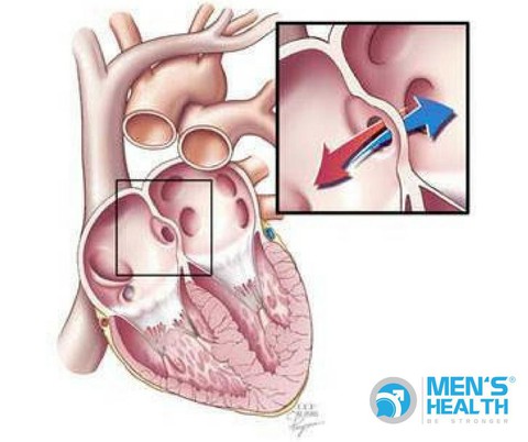 Biểu hiện thường gặp ở trẻ bị bệnh tim bẩm sinh và cách điều trị. - Ảnh 2. Biểu hiện thường gặp ở trẻ bị bệnh tim bẩm sinh và cách điều trị. - Ảnh 2.