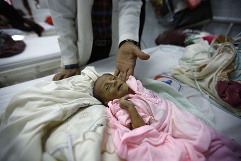 Ở Yemen, đến khóc cũng không còn nước mắt vì đói khát - Ảnh 1. Ở Yemen, đến khóc cũng không còn nước mắt vì đói khát - Ảnh 1.