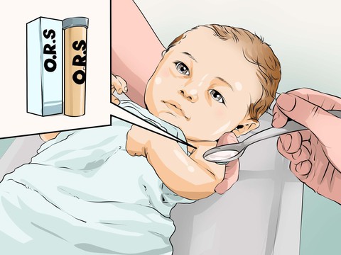 Chế độ ăn và nguyên tắc bù nước điện giải cho trẻ bị nôn - Ảnh 1. Chế độ ăn và nguyên tắc bù nước điện giải cho trẻ bị nôn - Ảnh 1.