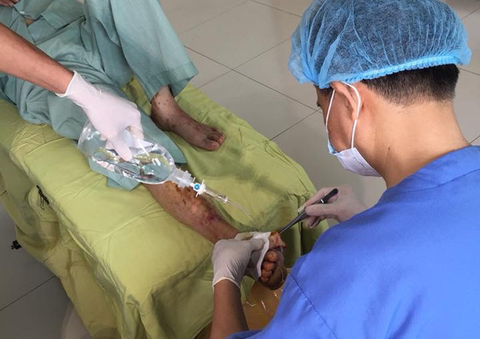 Kinh hoàng biến chứng bàn chân do mua thuốc trị tiểu đường - Ảnh 1. Kinh hoàng biến chứng bàn chân do mua thuốc trị tiểu đường - Ảnh 1.