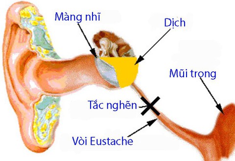 Bốn biến chứng thường gặp khi bé bị cảm lạnh - Ảnh 1. Bốn biến chứng thường gặp khi bé bị cảm lạnh - Ảnh 1.