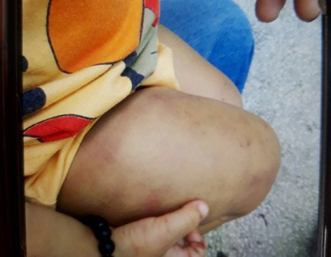 Điều tra vụ bé trai 3 tuổi nghi bị cha dượng bạo hành - Ảnh 3. Điều tra vụ bé trai 3 tuổi nghi bị cha dượng bạo hành - Ảnh 3.