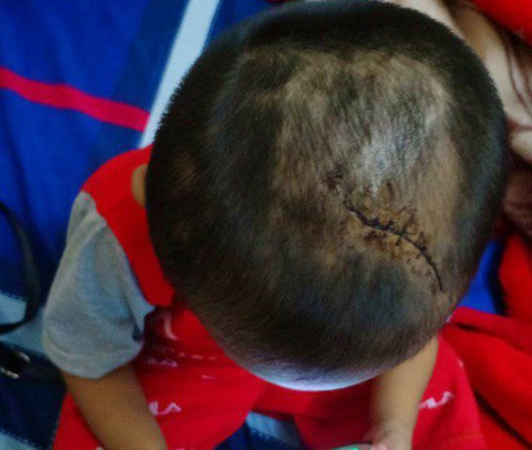Điều tra vụ bé trai 3 tuổi nghi bị cha dượng bạo hành - Ảnh 1. Điều tra vụ bé trai 3 tuổi nghi bị cha dượng bạo hành - Ảnh 1.
