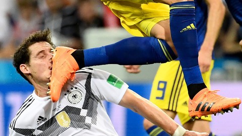 Sebastian Rudy gãy mũi, tuyển Đức gặp khó trước Hàn Quốc - Ảnh 1. Sebastian Rudy gãy mũi, tuyển Đức gặp khó trước Hàn Quốc - Ảnh 1.