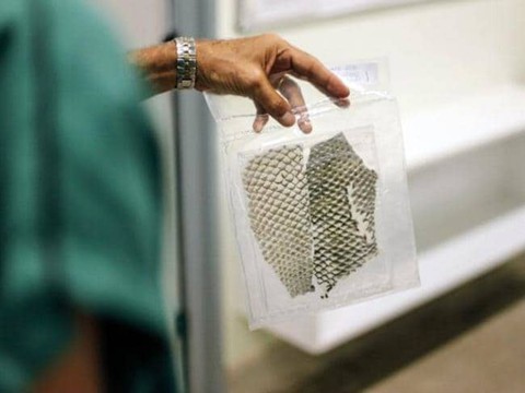 Cô gái được tạo âm đạo từ da cá rô phi đầu tiên trên thế giới - Ảnh 2. Cô gái được tạo âm đạo từ da cá rô phi đầu tiên trên thế giới - Ảnh 2.