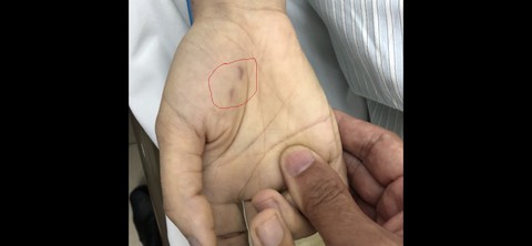 Bị chó dại cắn trong lúc chữa bệnh, nữ bác sĩ thú y trẻ tử vong - Ảnh 1. Bị chó dại cắn trong lúc chữa bệnh, nữ bác sĩ thú y trẻ tử vong - Ảnh 1.