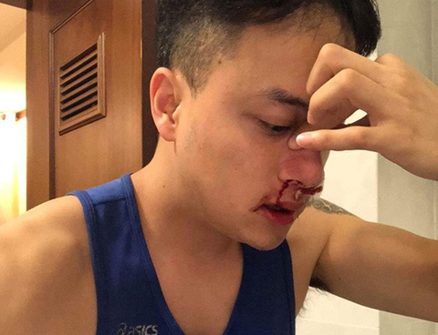 6-6: Quốc Cơ cầu hôn vợ, Cao Thái Sơn chảy máu mũi không ngừng - Ảnh 11. 6-6: Quốc Cơ cầu hôn vợ, Cao Thái Sơn chảy máu mũi không ngừng - Ảnh 11.