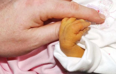 Vàng da sơ sinh và các biện pháp phòng ngừa - Ảnh 1. Vàng da sơ sinh và các biện pháp phòng ngừa - Ảnh 1.