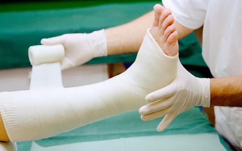 Hướng dẫn chăm sóc trẻ bó bột tại nhà - Ảnh 1. Hướng dẫn chăm sóc trẻ bó bột tại nhà - Ảnh 1.