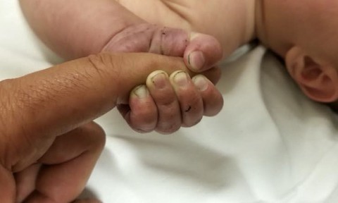 Em bé 5 tháng tuổi sống sót kỳ diệu sau 9 tiếng bị bỏ trong rừng - Ảnh 1. Em bé 5 tháng tuổi sống sót kỳ diệu sau 9 tiếng bị bỏ trong rừng - Ảnh 1.