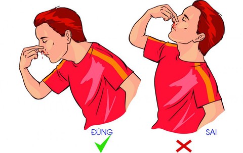 Làm gì khi chảy máu mũi? - Ảnh 1. Làm gì khi chảy máu mũi? - Ảnh 1.