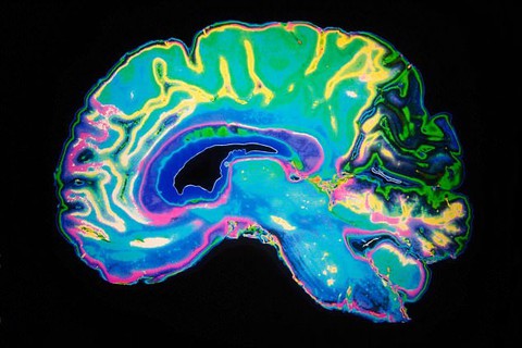 Quên các bài kiểm tra IQ đi, AI sẽ đo trí thông minh chỉ bằng ảnh chụp quét não - Ảnh 1. Quên các bài kiểm tra IQ đi, AI sẽ đo trí thông minh chỉ bằng ảnh chụp quét não - Ảnh 1.