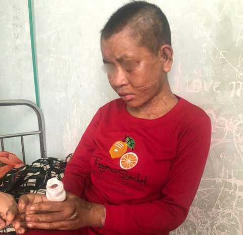 Một người làm thuê bị chủ đánh đến sẩy thai, gãy xương - Ảnh 1. Một người làm thuê bị chủ đánh đến sẩy thai, gãy xương - Ảnh 1.