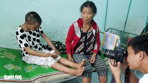Y Nhiêu và cuộc trốn chạy khỏi bàn tay quỷ - Ảnh 1. Y Nhiêu và cuộc trốn chạy khỏi bàn tay quỷ - Ảnh 1.
