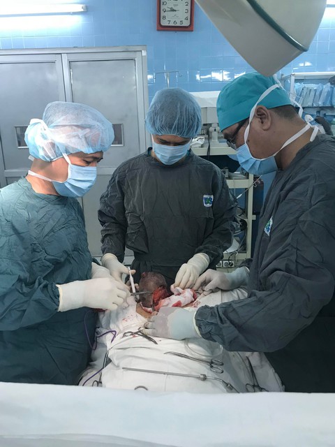 Phẫu thuật thành công khối bướu âm hộ đường kính 30cm - Ảnh 1. Phẫu thuật thành công khối bướu âm hộ đường kính 30cm - Ảnh 1.