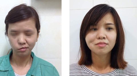 Cứu tinh của người bị liệt - Ảnh 1. Cứu tinh của người bị liệt - Ảnh 1.