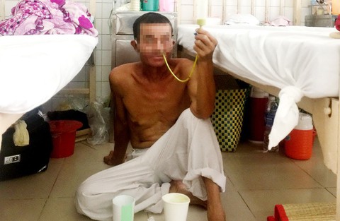 Ung thư ở người trẻ: Khi không ăn được bằng miệng - Ảnh 1. Ung thư ở người trẻ: Khi không ăn được bằng miệng - Ảnh 1.