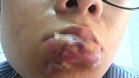 Bát nháo dịch vụ làm đẹp - Kỳ 2: Tiền mất tật mang - Ảnh 1. Bát nháo dịch vụ làm đẹp - Kỳ 2: Tiền mất tật mang - Ảnh 1.
