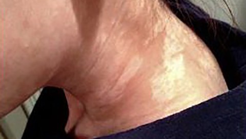 Mối nguy từ sản phẩm làm trắng da - Ảnh 1. Mối nguy từ sản phẩm làm trắng da - Ảnh 1.