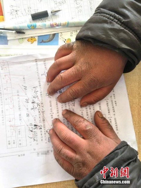 ‘Cậu bé đông đá’ làm rơi lệ cư dân mạng Trung Quốc - Ảnh 3. ‘Cậu bé đông đá’ làm rơi lệ cư dân mạng Trung Quốc - Ảnh 3.