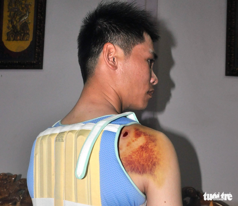 Khởi tố con trai bí thư xã bênh cha bắn người - Ảnh 1. Khởi tố con trai bí thư xã bênh cha bắn người - Ảnh 1.