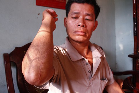 Người dân liên tiếp bị truy sát, công an nói đang điều tra - Ảnh 1. Người dân liên tiếp bị truy sát, công an nói đang điều tra - Ảnh 1.