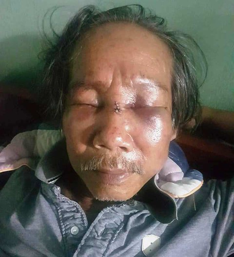 Bảo vệ chung cư đánh cụ ông 68 tuổi nhập viện - Ảnh 3. Bảo vệ chung cư đánh cụ ông 68 tuổi nhập viện - Ảnh 3.