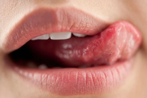 Vì sao môi lại bị thâm tím? - Ảnh 1. Vì sao môi lại bị thâm tím? - Ảnh 1.
