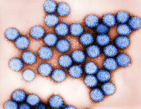 Viêm dạ dày-ruột do rotavirus - Ảnh 1. Viêm dạ dày-ruột do rotavirus - Ảnh 1.