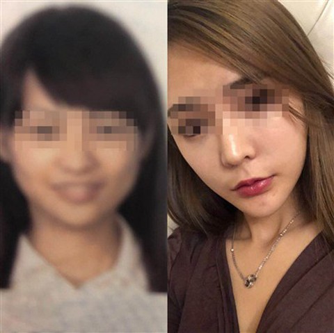 Không qua được cổng an ninh vì phẫu thuật thẩm mỹ - Ảnh 1. Không qua được cổng an ninh vì phẫu thuật thẩm mỹ - Ảnh 1.