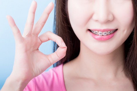 Phương pháp niềng răng phù hợp cho tuổi thanh, thiếu niên - Ảnh 2. Phương pháp niềng răng phù hợp cho tuổi thanh, thiếu niên - Ảnh 2.