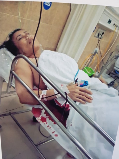 Truy xét nhóm giang hồ xăm mình đi ôtô, chém người đòi nợ - Ảnh 1. Truy xét nhóm giang hồ xăm mình đi ôtô, chém người đòi nợ - Ảnh 1.