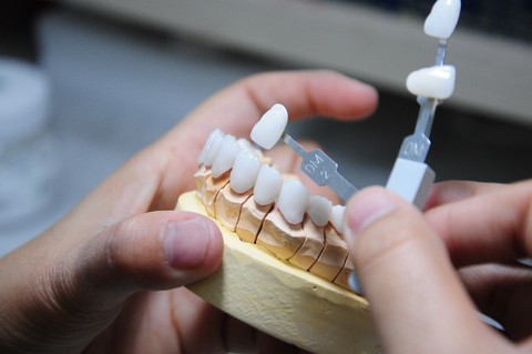 Tự tin hơn với hàm răng trắng đẹp - Ảnh 5. Tự tin hơn với hàm răng trắng đẹp - Ảnh 5.