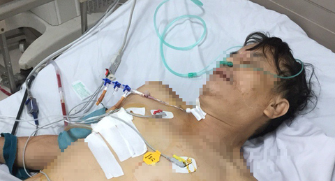 Cứu sống bệnh nhân vỡ một phần tim - Ảnh 1. Cứu sống bệnh nhân vỡ một phần tim - Ảnh 1.