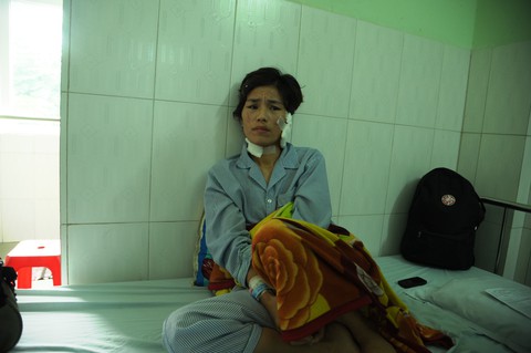 Bắt người chồng cắt đứt tai, rạch mặt, hành hạ vợ cũ - Ảnh 1. Bắt người chồng cắt đứt tai, rạch mặt, hành hạ vợ cũ - Ảnh 1.