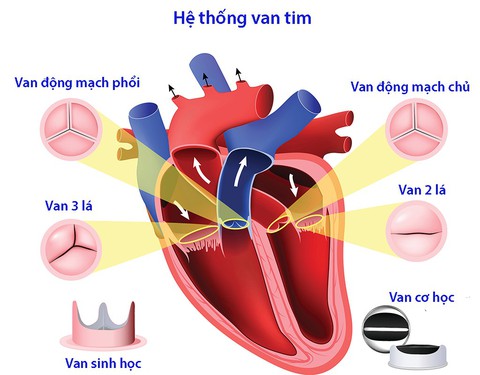Các bệnh van tim thường gặp - Ảnh 1. Các bệnh van tim thường gặp - Ảnh 1.