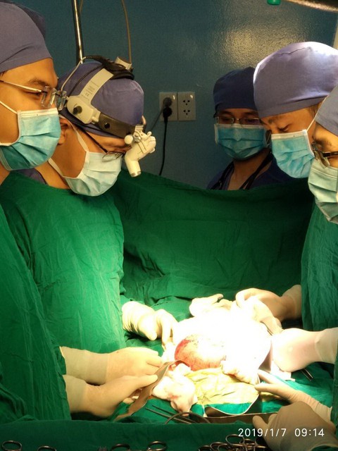 Một bé trai bụng phình to vì có thai trong thai - Ảnh 1. Một bé trai bụng phình to vì có thai trong thai - Ảnh 1.