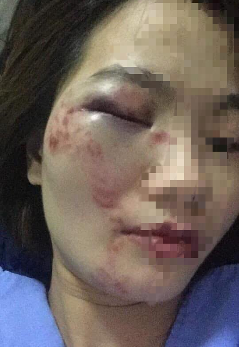 4 khách nam lao vào đánh nữ nhân viên xe buýt vì bị nhắc nhở giữ trật tự? - Ảnh 1. 4 khách nam lao vào đánh nữ nhân viên xe buýt vì bị nhắc nhở giữ trật tự? - Ảnh 1.