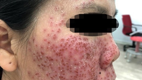 Lột da xong, chạy mặt mình luôn - Ảnh 1. Lột da xong, chạy mặt mình luôn - Ảnh 1.