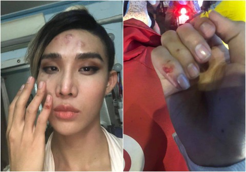 Người mẫu The Face tố bị tài xế Go Viet đánh vào mặt và bóp cổ - Ảnh 1. Người mẫu The Face tố bị tài xế Go Viet đánh vào mặt và bóp cổ - Ảnh 1.