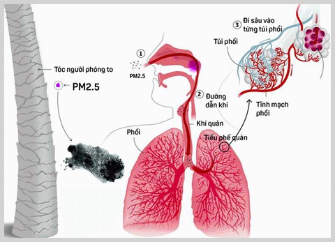Tác hại khôn lường từ ô nhiễm không khí đến sức khỏe - Ảnh 2. Tác hại khôn lường từ ô nhiễm không khí đến sức khỏe - Ảnh 2.