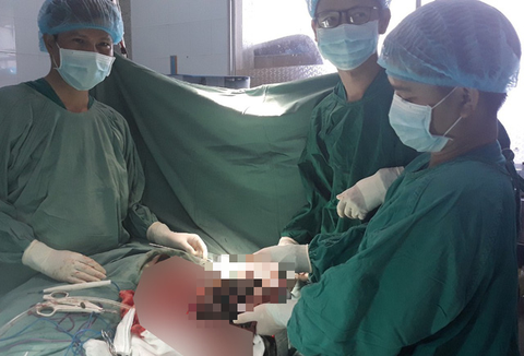 Mổ tách thành công khối u vú nặng 6kg cho cụ bà 73 tuổi - Ảnh 1. Mổ tách thành công khối u vú nặng 6kg cho cụ bà 73 tuổi - Ảnh 1.