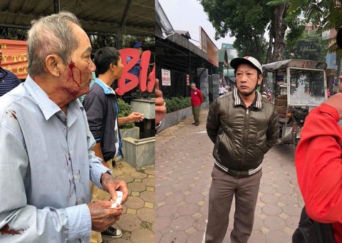 Cụ ông 80 tuổi bị gã xe ôm bắn súng cao su vào mặt, đánh rạn xương sườn - Ảnh 1. Cụ ông 80 tuổi bị gã xe ôm bắn súng cao su vào mặt, đánh rạn xương sườn - Ảnh 1.