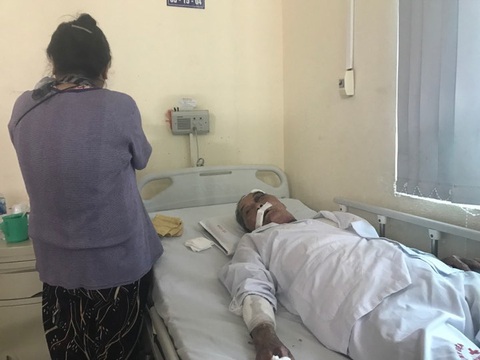Cụ ông 80 tuổi bị gã xe ôm bắn súng cao su vào mặt, đánh rạn xương sườn - Ảnh 2. Cụ ông 80 tuổi bị gã xe ôm bắn súng cao su vào mặt, đánh rạn xương sườn - Ảnh 2.