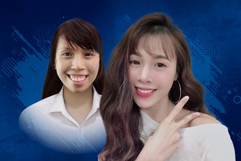 Góc nhìn mới về phẫu thuật thẩm mỹ - Ảnh 3. Góc nhìn mới về phẫu thuật thẩm mỹ - Ảnh 3.