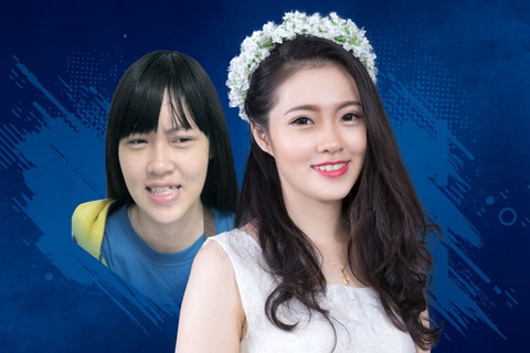 Góc nhìn mới về phẫu thuật thẩm mỹ - Ảnh 4. Góc nhìn mới về phẫu thuật thẩm mỹ - Ảnh 4.