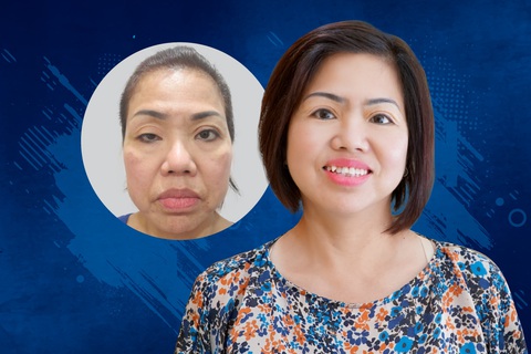Góc nhìn mới về phẫu thuật thẩm mỹ - Ảnh 5. Góc nhìn mới về phẫu thuật thẩm mỹ - Ảnh 5.