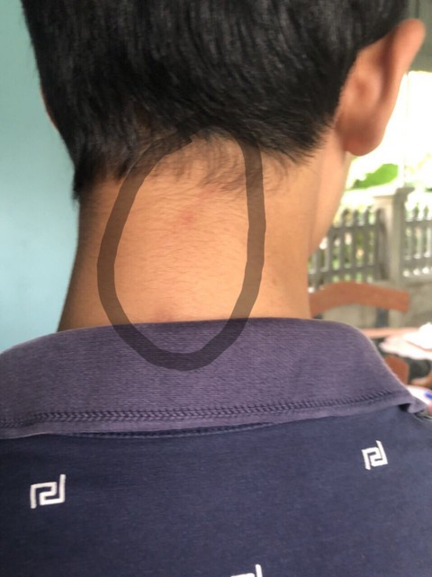 5 người lớn đi ôtô xông vào trường đánh 1 nam sinh lớp 8 - Ảnh 1. 5 người lớn đi ôtô xông vào trường đánh 1 nam sinh lớp 8 - Ảnh 1.