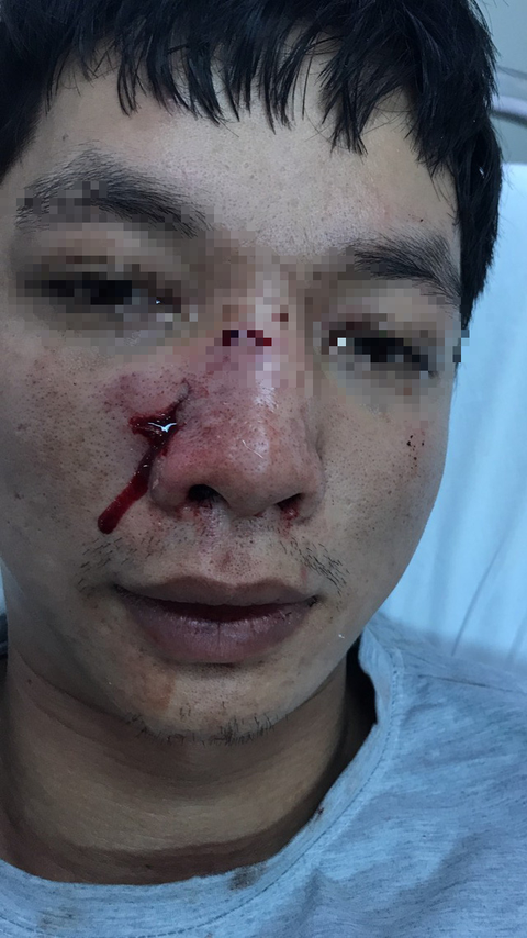 Thu bẫy thú của dân, cán bộ bảo vệ rừng bị hành hung ngay tại cơ quan - Ảnh 2. Thu bẫy thú của dân, cán bộ bảo vệ rừng bị hành hung ngay tại cơ quan - Ảnh 2.