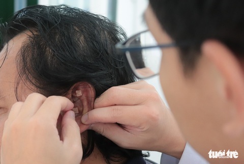 TP.HCM có nơi đầu tiên cai nghiện thuốc lá thành công bằng châm cứu, bấm huyệt - Ảnh 1. TP.HCM có nơi đầu tiên cai nghiện thuốc lá thành công bằng châm cứu, bấm huyệt - Ảnh 1.